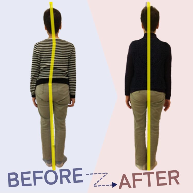 腰痛・肩こり・首痛 専門整体院 リハイロ　　Before After