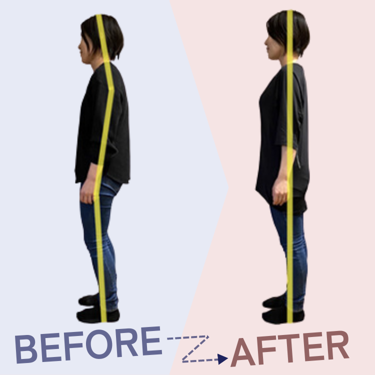 腰痛・肩こり・首痛 専門整体院 リハイロ　　Before After